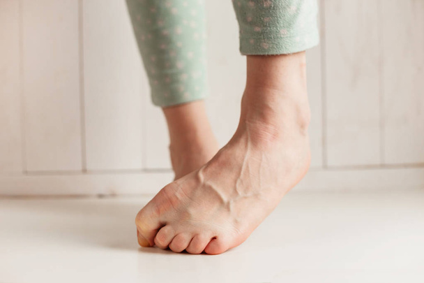 Müde Fußgelenke von Frauen mit verschränkten Fingern und prallen Adern in Großaufnahme auf hellem Hintergrund. - Foto, Bild