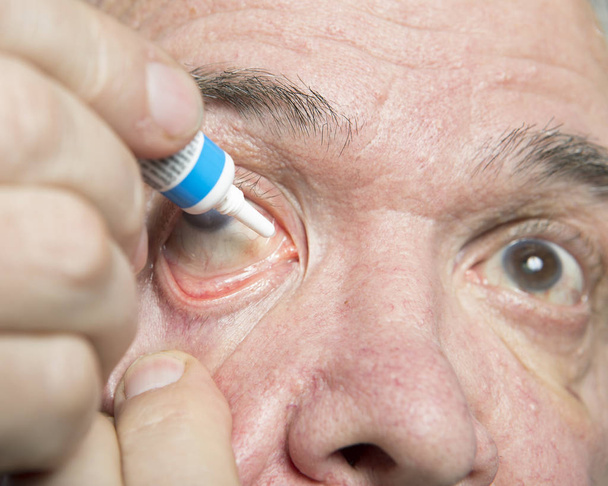 Eye disease treatment - Photo, Image