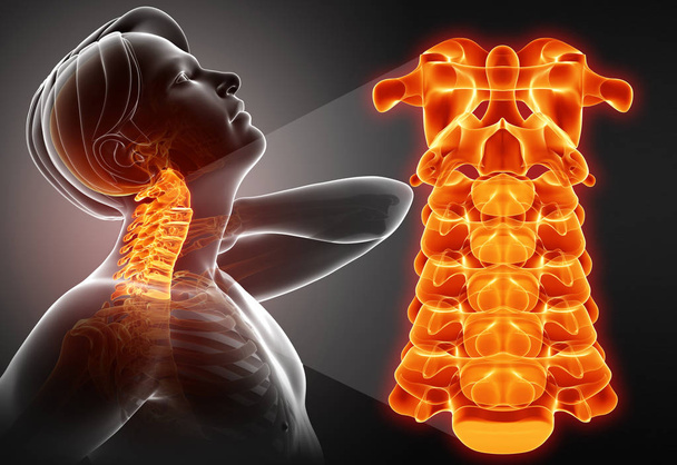 3D illustratie van mannelijke gevoel de nekpijn - Foto, afbeelding