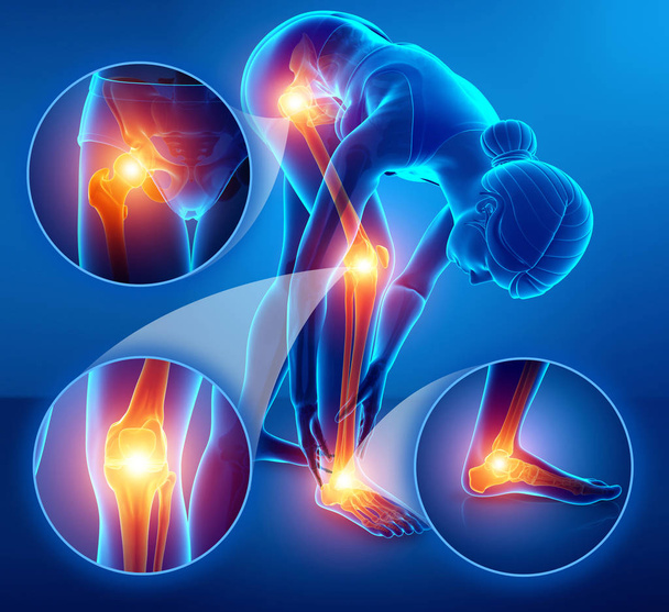 3d Illustration du sentiment féminin Douleur aux jambes
 - Photo, image