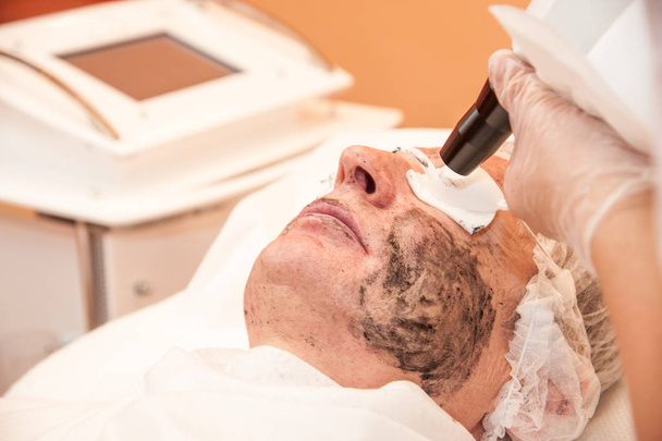 traitement laser carbone traitement peau / laser
 - Photo, image