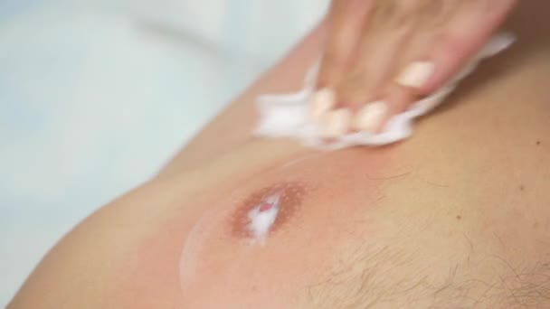 Skin Care After Epilation of a Mans Nipple - 映像、動画