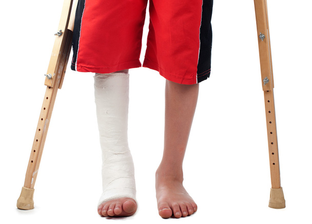 Fracture de jambe
 - Photo, image