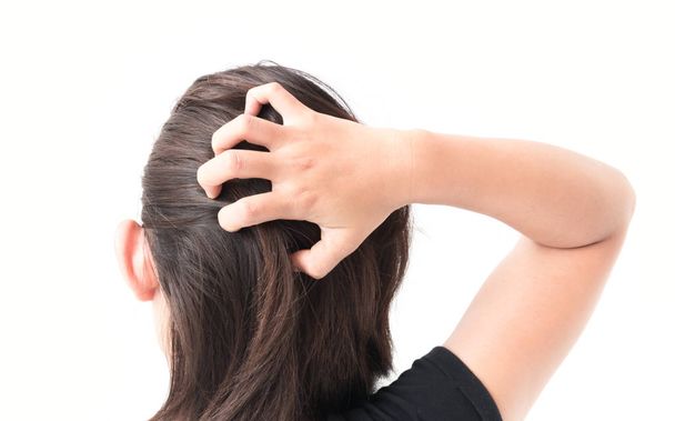 Closeup vrouw hand jeukende hoofdhuid, Hair care concept - Foto, afbeelding