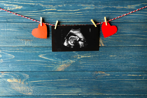 Ultrasound scan of baby on rope - Fotografie, Obrázek