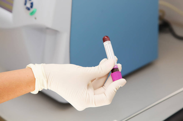 Blood sample in flask - Foto, Imagen