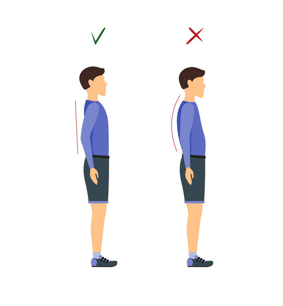 Correct or Incorrect Standing and Walking Posture. Vector - Вектор, зображення