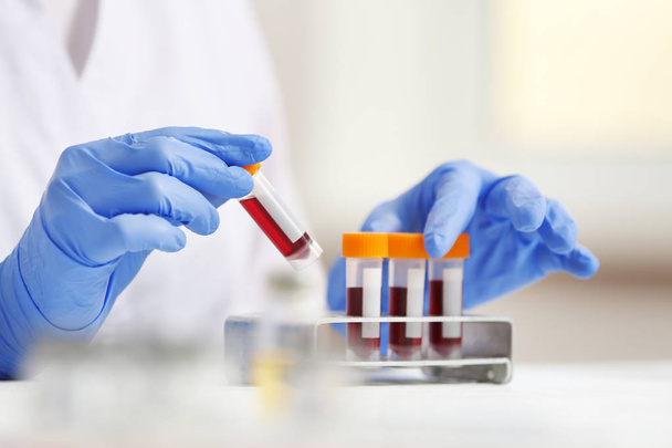 Woman working with blood samples  - Foto, afbeelding