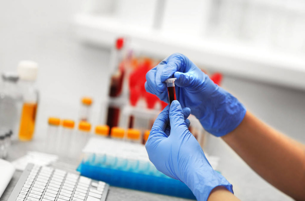Scientist working with blood samples - Foto, imagen