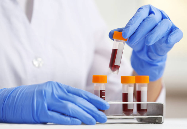 Woman working with blood samples  - Foto, imagen