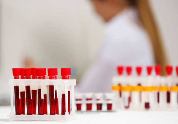 Test tubes with blood samples - Фото, зображення