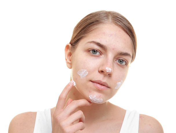 白い背景の上の顔にトラブル肌のためのクリームを適用する美しい若い女性 - 写真・画像
