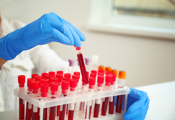 Woman working with blood samples  - Foto, Bild