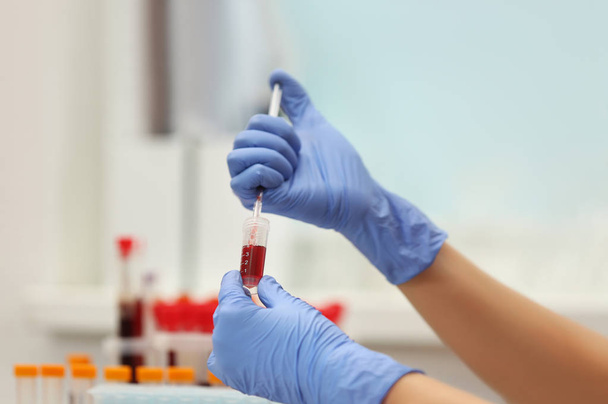 Scientist working with blood samples - Foto, imagen