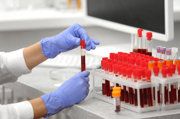 Scientist working with blood samples - Фото, зображення