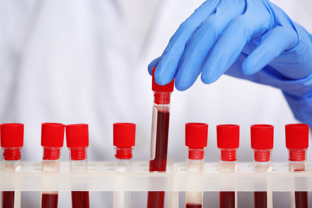 Woman working with blood samples  - Photo, image