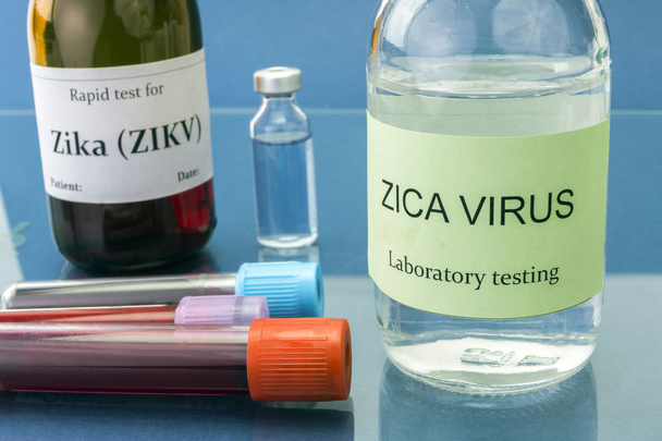 Tests zur Erforschung des Zika-Virus - Foto, Bild