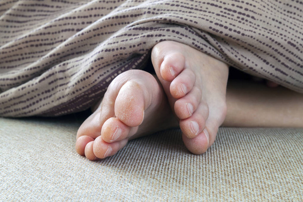 Pelle secca screpolata di piedi di donna a letto. Trattamento del piede
. - Foto, immagini