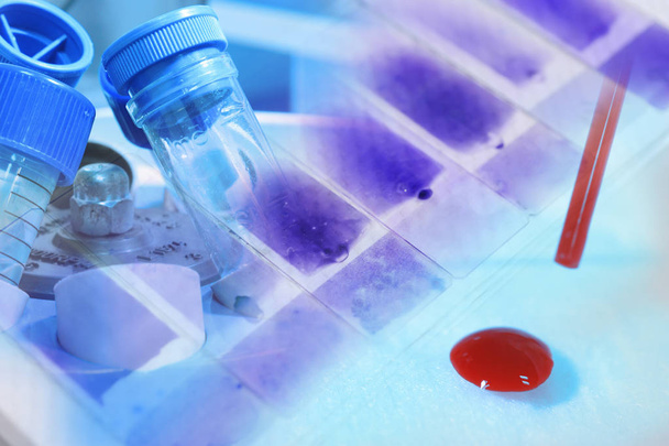 verikokeet laboratoriossa
  - Valokuva, kuva