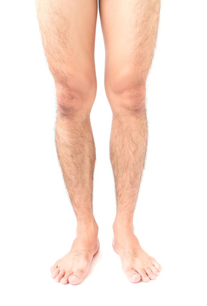 クローズ アップ足肌と白い背景、健康管理と医療の概念で毛むくじゃらの男性 - 写真・画像