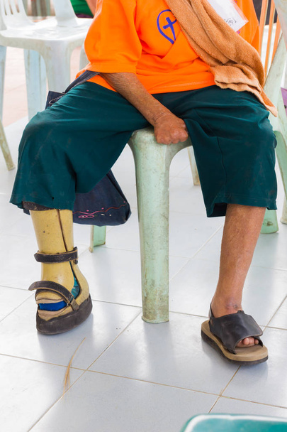 closeup asian old leprosy woman with aluminium prostheses  - Photo, Image