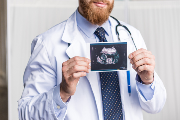 Doctor holding ultrasound scan  - Fotoğraf, Görsel