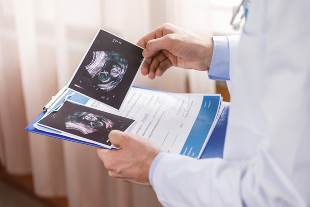 Doktor drží ultrazvukové vyšetření  - Fotografie, Obrázek