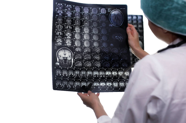 Γιατρός κρατώντας μια εικόνα μιας μαγνητικής τομογραφίας εγκεφάλου - Φωτογραφία, εικόνα