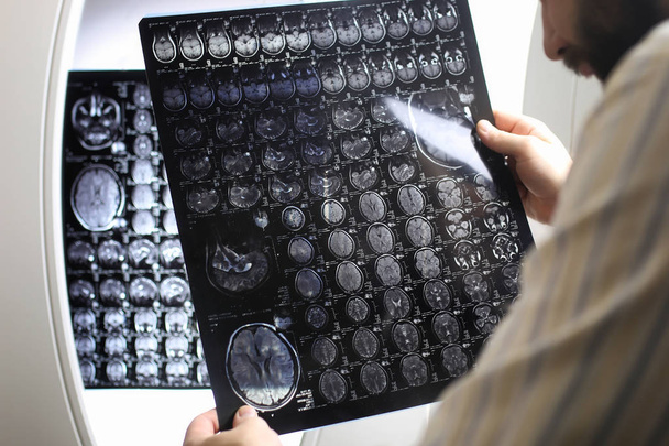 Médecin tenant une image d'un flux de travail d'IRM cérébrale
 - Photo, image