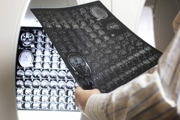 Γιατρός κρατώντας μια εικόνα μιας ροής εργασίας MRI εγκεφάλου - Φωτογραφία, εικόνα