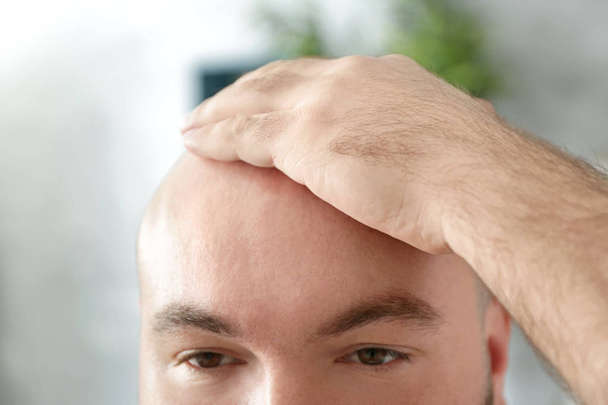 Bald adult man  - Фото, изображение