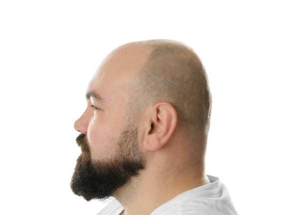Bald adult man   - Photo, Image