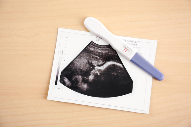 Φωτογραφία υπερηχογράφημα και τεστ εγκυμοσύνης  - Φωτογραφία, εικόνα