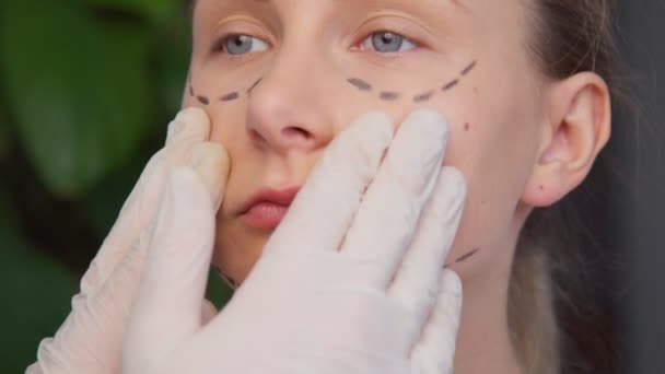 Plastic surgeon marking woman face. - Filmati, video