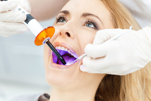 Sbiancamento dei denti paziente dal dentista - Foto, immagini