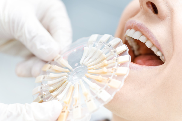 Zubař srovnání zubů pacienta s vzorky - Fotografie, Obrázek