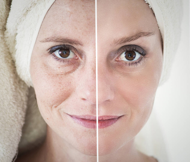 Schönheitskonzept - Hautpflege, Anti-Aging-Verfahren, Verjüngung, - Foto, Bild
