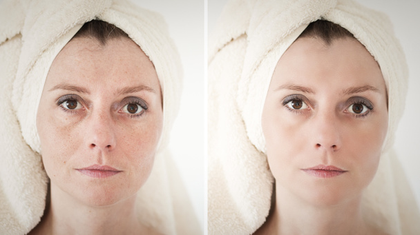 Концепція краси: догляд за шкірою, антивікові процедури, омолодження
, - Фото, зображення