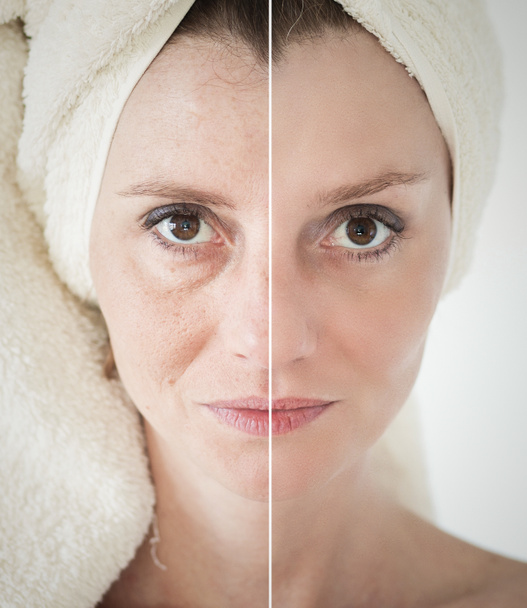 Concepto de belleza: cuidado de la piel, procedimientos antienvejecimiento, rejuvenecimiento
, - Foto, imagen