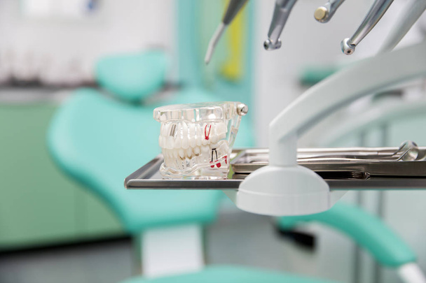 Модельные протезы в стоматологическом кабинете
 - Фото, изображение