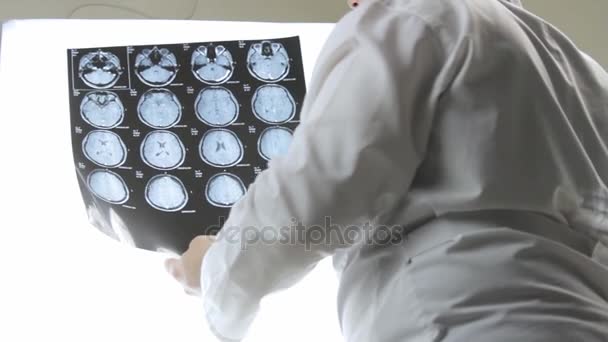 El médico tiene en sus manos una resonancia magnética del cerebro, diagnóstico
 - Imágenes, Vídeo