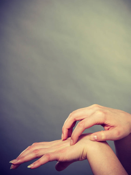 female scratching her itchy palm with allergy rash - Fotografie, Obrázek