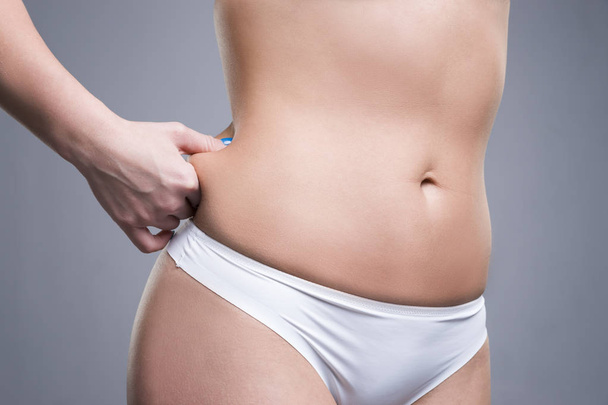 Woman holding fold of skin, cellulite on female body, gray background - Fotografie, Obrázek