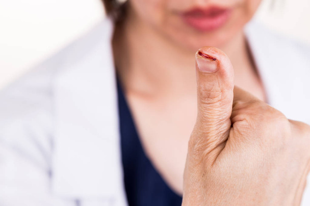 Болезненный палец большого пальца с повреждением
 - Фото, изображение