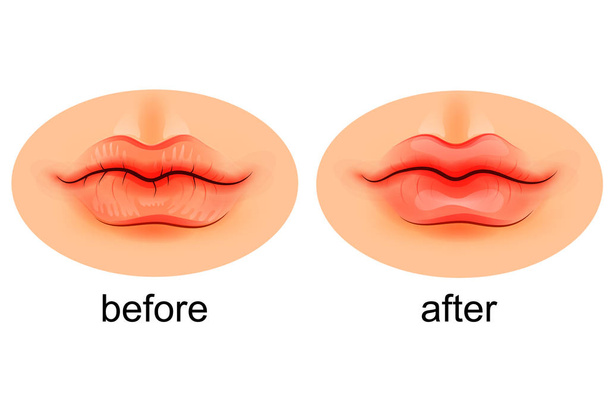 lips are dry and after moistening - Vector, Image