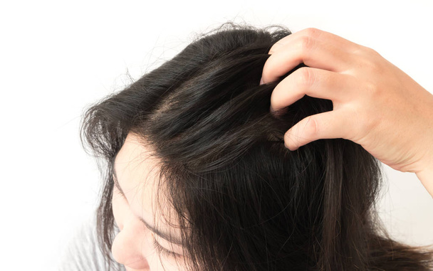 Vértes nő kéz viszkető fejbőr, haj ellátás fogalma - Fotó, kép