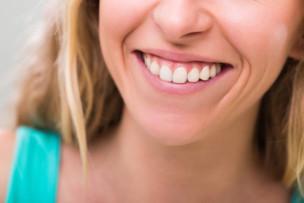 Close up photo of healthy white teeth - Photo, Image