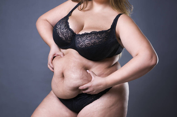 Woman with fat abdomen, overweight female stomach, stretch marks on belly closeup - Φωτογραφία, εικόνα