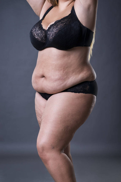Woman with fat abdomen, overweight female stomach, stretch marks on belly - Φωτογραφία, εικόνα