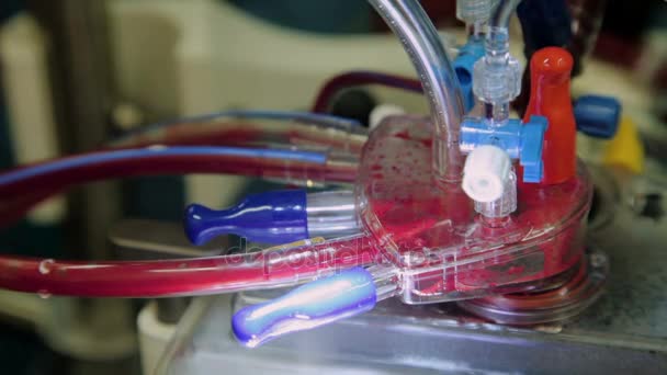 Close-up operando a máquina coração-pulmão com tubos e retalhos que corre o sangue
 - Filmagem, Vídeo
